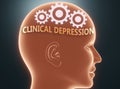 Clinical depression inside human mind - pictured as word Clinical depression inside a head with cogwheels to symbolize that