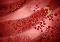 Clogged Artery with platelets and cholesterol plaque, concept for health risk for obesity or dieting and nutrition problems Royalty Free Stock Photo