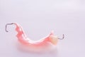 Acrylic denture with metal clasps for restoring dentition