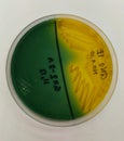 Close up agar plate and biochem test.