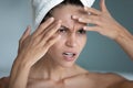 Close up angry unhappy woman squeezing pimple on forehead