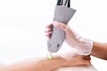 Close up of arm laser hair removal session with beauty technician and female patient, epilating after shaving, in a cosmetology