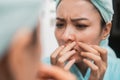 close up of asian girl squeezing pimple on the cheek to the mirror Royalty Free Stock Photo