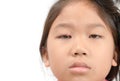 Close up of asian little girl one eye infection isolated Royalty Free Stock Photo