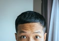 Close up of asian man with forehead wrinkles,Aging of the skin Royalty Free Stock Photo