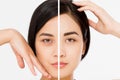 Before after close up asian woman face. Skin care and beauty concept