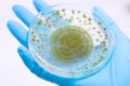 Aspergillus oryzae is a filamentous fungus, or mold that is used in food production, such as in soybean fermentation.