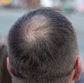 Close-up of a bald spot on a man& x27;s head. Royalty Free Stock Photo