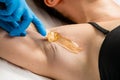 Close up of beautician waxing female armpit Royalty Free Stock Photo