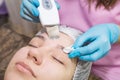 Close-up Of Beautiful Woman Receiving Ultrasound Cavitation Facial Peeling. Ultrasonic Skin Cleansing Procedure. Beauty Treatment Royalty Free Stock Photo