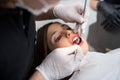 Close up of beautiful young woman having dental check up in dental clinic