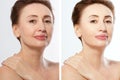 Close up before after Beauty middle age woman face portrait. Spa and anti aging concept Isolated on white background. Plastic