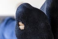 Close-up of a sock with a hole in it Royalty Free Stock Photo