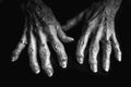 A close up black and white image of an elderly woman\'s arthritic hands.