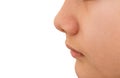 Close up blackhead pimples on the nose of a teenage boy. Skincare acne problem