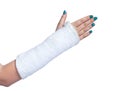 Close up of a broken arm Royalty Free Stock Photo