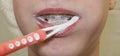 Close-up of brushing teeth with braces. Royalty Free Stock Photo