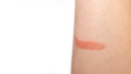 Close up burning skin on arm, Injury from fire. Painful burn marks on arms. Skin Burn Treatment Royalty Free Stock Photo