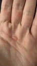 Close up of calluses on the palms Royalty Free Stock Photo