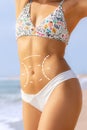 Conceptual tummy tuck incision contour lines on female torso Royalty Free Stock Photo