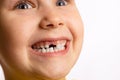 Close-up of cute young girl face smiling showing missing front milk tooth looking up on white background. First teeth