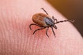 Female deer tick on skin of human finger. Ixodes ricinus or scapularis