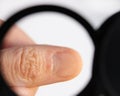 Close-up of dead thin skin at the base of the nails on the fingers.