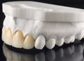 Close-up of dental prosthesis porcelain teeth in a mold. Dental technician working in a ceramic crowns. Technical shots of tooth