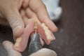 Close up Dental technician work on denture prothesis in dental l