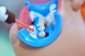 Dentist applies gel to teeth before teeth whitening procedure