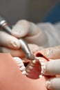 Close-up of dentist hands who is learning to treat teeth on human head mannequin. Hands of medical student in white Royalty Free Stock Photo