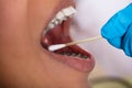 Dentist Making Saliva Test On The Mouth With Cotton Swab Royalty Free Stock Photo