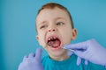 Close up of dentist`s hands with assistant in blue gloves are treating teeth to a child, patient`s face is closed Royalty Free Stock Photo