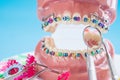 Close up dentist tools and orthodontic model. Royalty Free Stock Photo