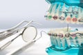 Close up dentist tools and orthodontic model. Royalty Free Stock Photo