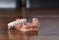 Close up of dentures with gold teeth Royalty Free Stock Photo