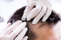 Dermatologist Checking Patient`s Hair Royalty Free Stock Photo