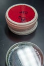 Agar plates with CSF samples Royalty Free Stock Photo