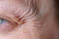 Close-up details of the crows feet and wrinkled skin around the eye