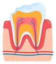 Close-up diagram of human tooth anatomy with enamel, dentin, pulp, and gums. Educational dental care and oral hygiene