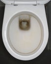 Dirty toilet bowl