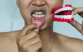Close up of diseased black gum,Yellow teeth of man patient causes of smoking