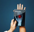 Doctor With Digital Tablet Scans Patient Hand On Blue Background, Modern X-Ray Technology In Medicine And Healthcare Concept Royalty Free Stock Photo