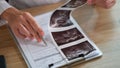 Close-up of doctor filling out medical paperwork. Royalty Free Stock Photo