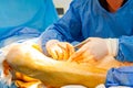 Close up of doctor hand while surgeon and assistant performing surgery on . Medical team using various surgical instruments in Royalty Free Stock Photo