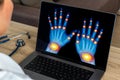 Close up of doctor looking x-ray of hands Royalty Free Stock Photo