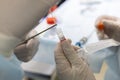 Close-up. The doctor places a piece of tissue from an endoscopic biopsy forceps into a jar. Selection of material for Royalty Free Stock Photo