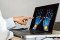 Close up of doctor showing x-ray of hands Royalty Free Stock Photo