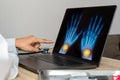 Close up of doctor showing x-ray of hands Royalty Free Stock Photo