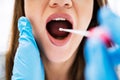 Close-up Of A Doctor Taking Saliva Sample For DNA Test Royalty Free Stock Photo